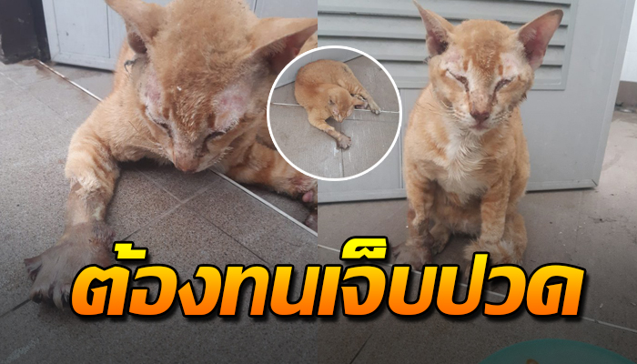 ต้องทนเจ็บมา 5 วัน หลังตัวถูกหม้อแปลงแตกใส่ นิ้วบวมเป่งไม่ส่งเสียงร้อง